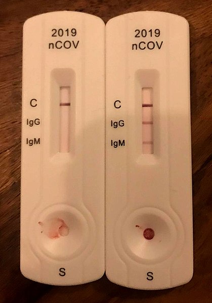 2. ábra (A kép forrása: https://en.wikipedia.org/wiki/File:IgGIgM-Covid19-Test.jpg)